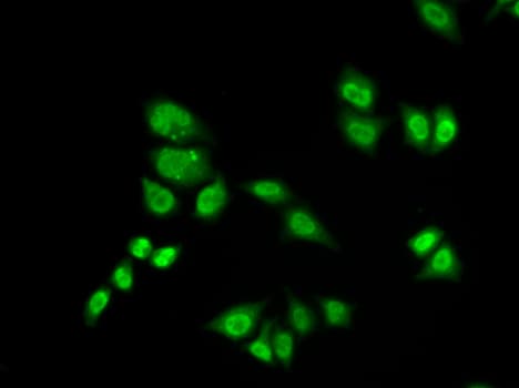 RAP30 / GTF2F2 Antibody