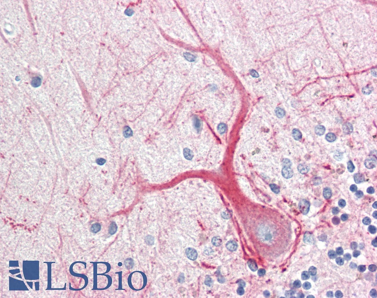 IHC-plus™ INA / Alpha Internexin Antibody