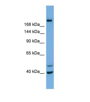 Polyclonal Rabbit anti-Human INPP5F Antibody (aa83-132, WB)