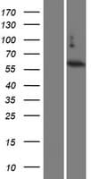 TBC1D3 Protein (Over-Expression Lysate Myc-DDK (Flag))