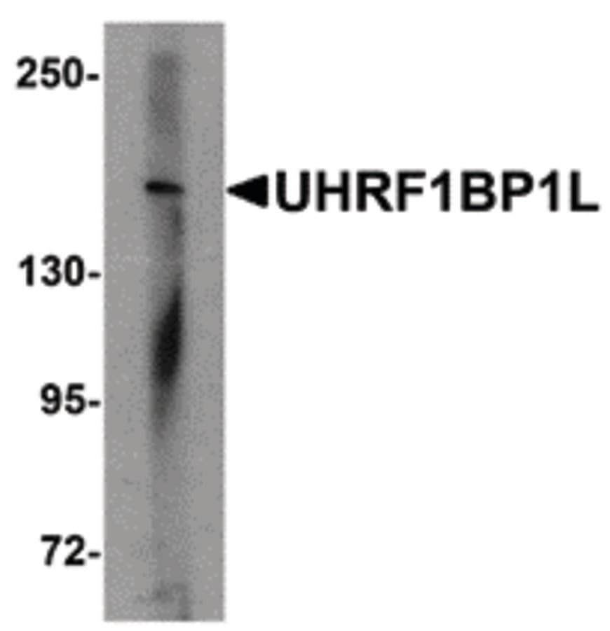 UHRF1BP1L / KIAA0701 Antibody