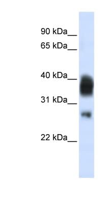 RNASEH1 Antibody (C-Terminus)
