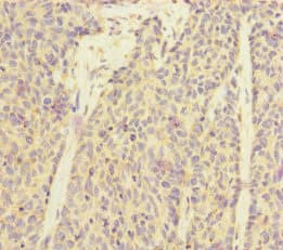 Polyclonal Rabbit anti-Human SUCLA2 Antibody (IHC, WB)