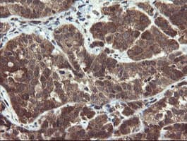 PPAT Antibody (aa42-278, clone OTI1B11)