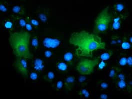 TCP11L2 Antibody (clone OTI3H7)