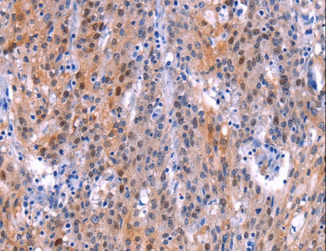 Polyclonal Rabbit anti-Human ADM2 / Adrenomedullin 2 Antibody (IHC)