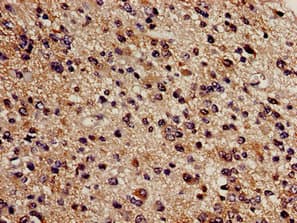 Polyclonal Rabbit anti-Human CBS Antibody (IHC, IF, WB)
