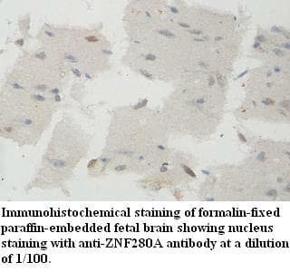 Polyclonal Rabbit anti-Human ZNF280A Antibody (aa270-530, IHC, WB)