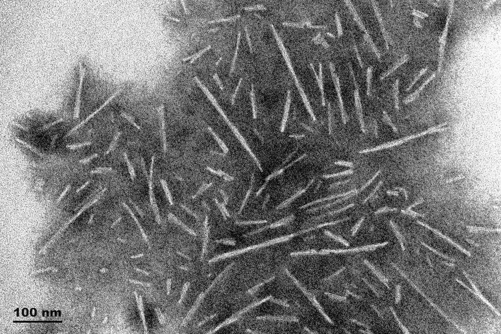 Human SNCA / Alpha-Synuclein Protein (Recombinant)