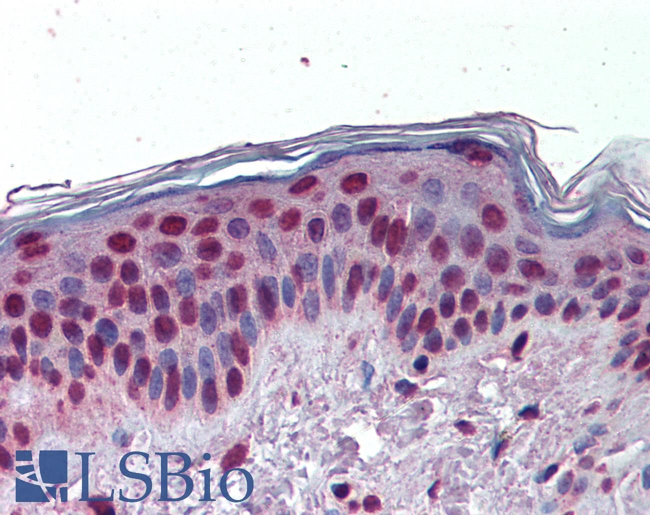 IHC-plus™ Polyclonal Rabbit anti-Human KDM1A / LSD1 Antibody (IHC, IF, WB)