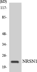 CYB561D2 Antibody (aa37-86)