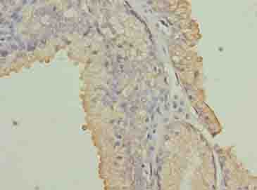NRARP Antibody