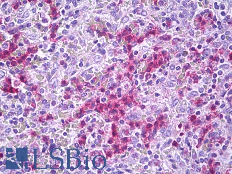 IHC-plus™ GPR34 Antibody (aa181-230)
