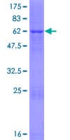 Human FN3K / Fructosamine-3-Kinase Protein (Recombinant GST)