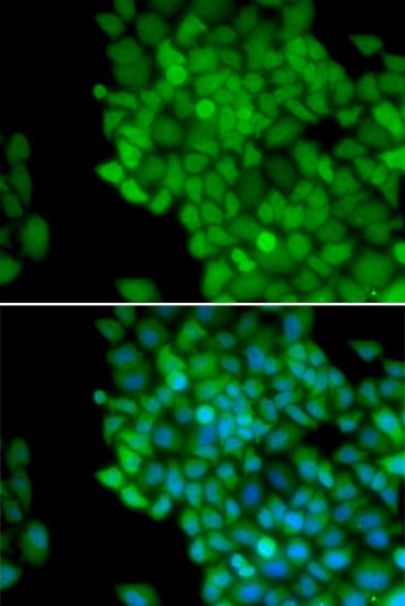 MAGEA1 / MAGE 1 Antibody
