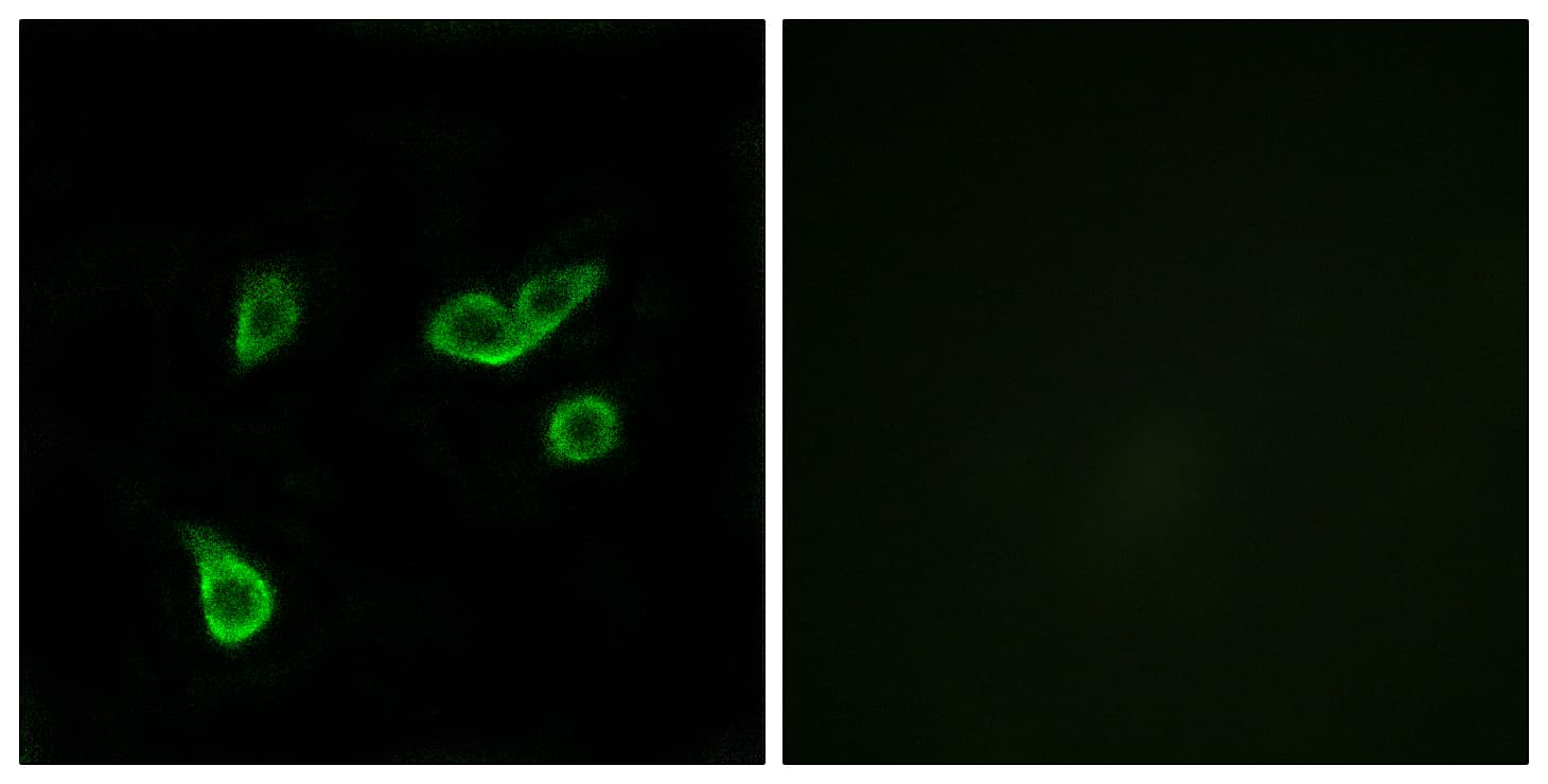 GPR35 Antibody (aa51-100)