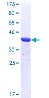 Human TPX2 Protein (Recombinant GST, N-terminus)