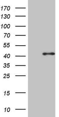 CDCA8 / Borealin Antibody (clone OTI9D1)