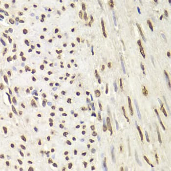 Polyclonal Rabbit anti-Human HNRNPD / AUF1 Antibody (IHC, WB)