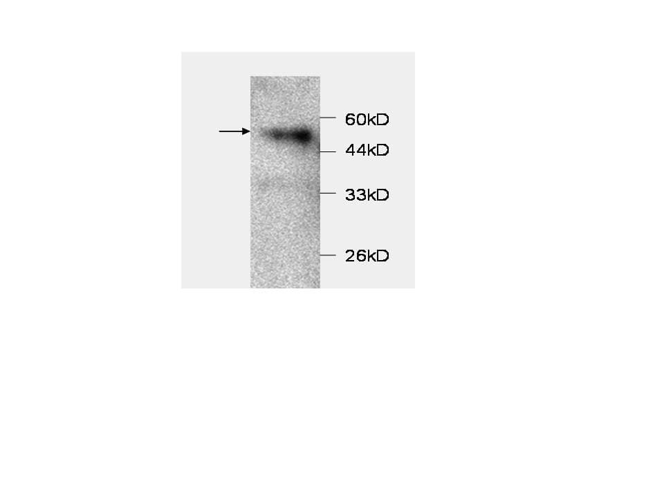 CCL2 / MCP1 Antibody