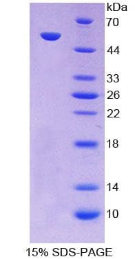Human PC / Pyruvate Carboxylase Protein (Recombinant His-T7)