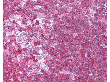 IHC-plus™ SIPA1 Antibody