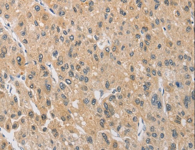 Polyclonal Rabbit anti-Human ARHGEF5 Antibody (IHC)
