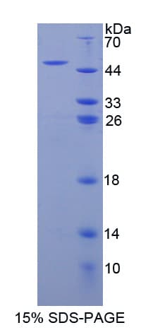 Human ADCY8 / Adenylate Cyclase 8 Protein (Recombinant His-GST-S)