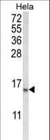 CLP / COTL1 Antibody (aa115-142)