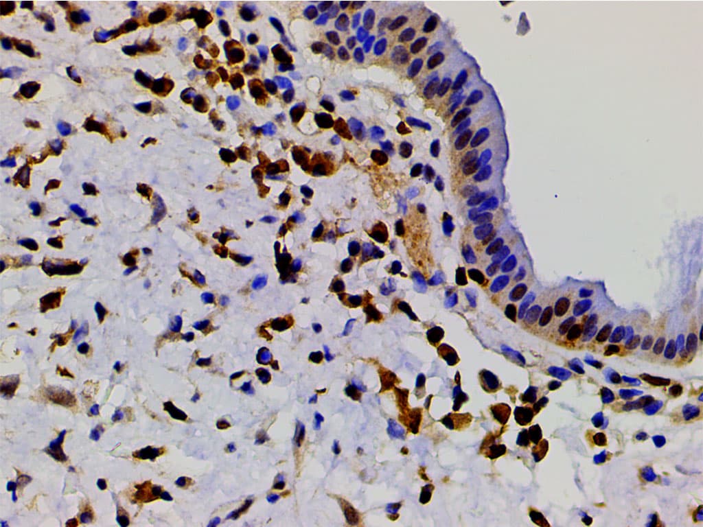 CFL1 / Cofilin Antibody (phospho-Ser3)