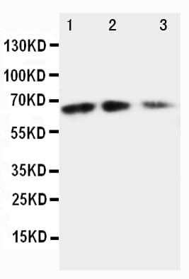 Polyclonal Rabbit anti-Mouse CX3CL1 / Fractalkine Antibody (aa74-92, IHC, WB)