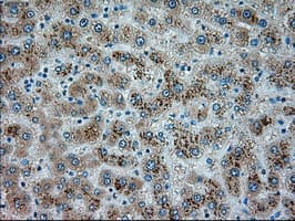 SERPINA1 / Alpha 1 Antitrypsin Antibody (clone OTI8E3)