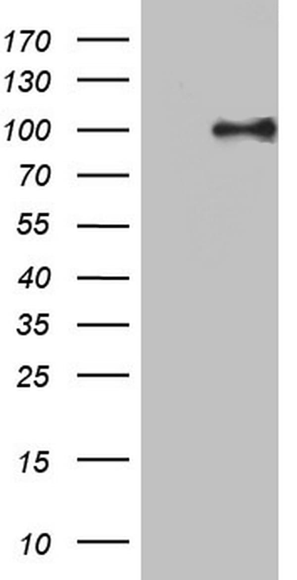 PIK3CD / PI3K Delta Antibody (aa286-610, clone OTI1F8, Carrier-free)
