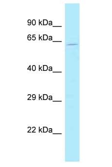 SP32 / ACRBP Antibody (aa14-63)