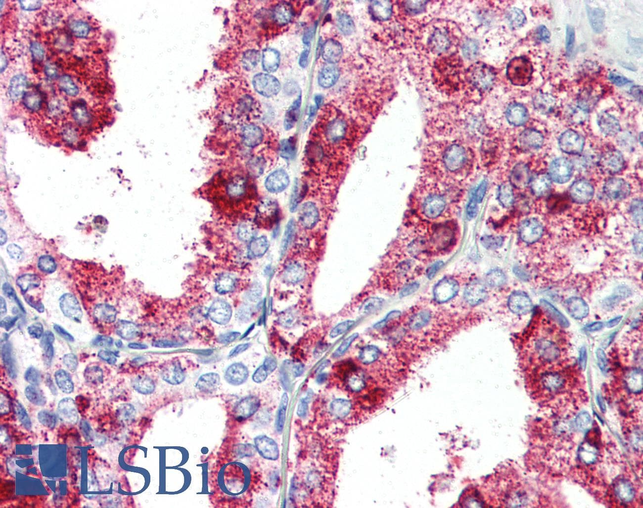 IHC-plus™ Polyclonal Rabbit anti-Human GPR27 Antibody (Cytoplasmic Domain, IHC)