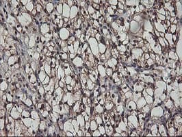 AKT1 Antibody (clone OTI4D6)