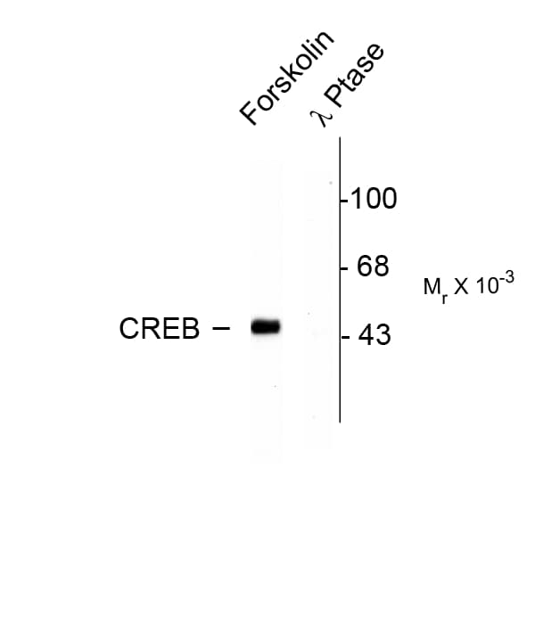 CREB1 / CREB Antibody (phospho-Ser133)