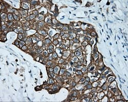 SRR / Serine Racemase Antibody (clone OTI2E3)