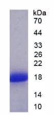Human SFRP5 Protein (Recombinant His)