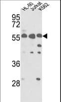 Polyclonal Rabbit anti-Human PICK1 Antibody (aa286-316, WB)