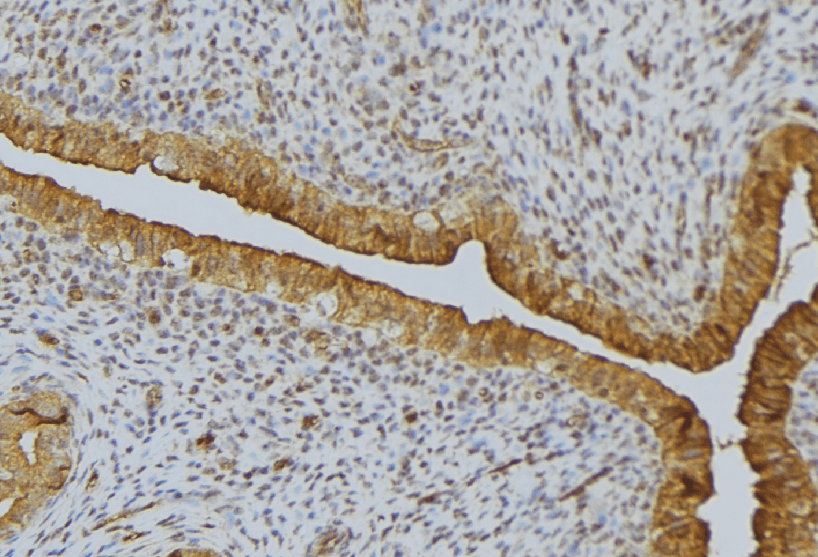 SCRN2 / Ses2 Antibody
