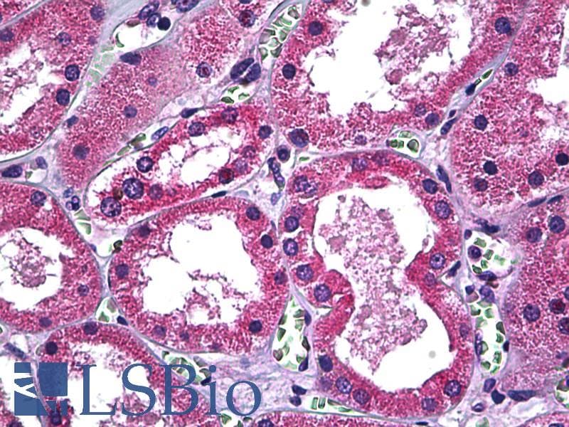 IHC-plus™ SLC11A2 / DMT1 Antibody (clone 4C6)