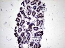 Monoclonal Mouse anti-Human NBN / Nibrin Antibody (clone OTI8E7, IHC, WB)