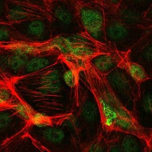 JUN / c-Jun Antibody (clone 5B1)