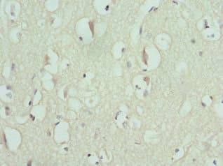 Polyclonal Rabbit anti-Human ENTPD2 Antibody (IHC, WB)