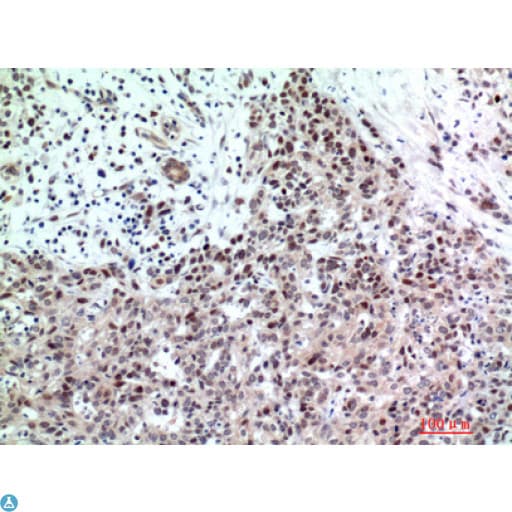 Polyclonal Rabbit anti-Human TP53INP2 Antibody (IHC, WB)