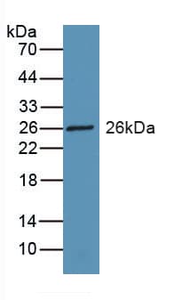 RBP3 / IRBP Antibody (aa1027-1229, Biotin)