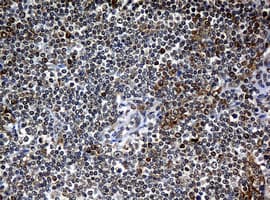 NBN / Nibrin Antibody (clone OTI3A2)
