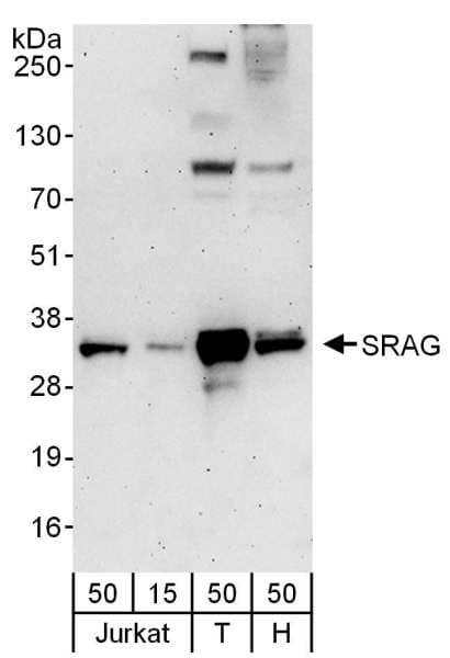 CHTOP / FOP Antibody (aa198-248)