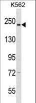 Polyclonal Rabbit anti-Human NCAPD3 / HCAP-D3 Antibody (aa1050-1078, WB)